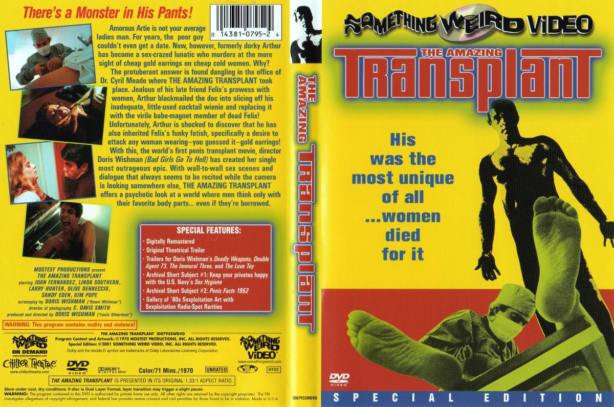 The Amazing Transplant / Удивительный трансплантат